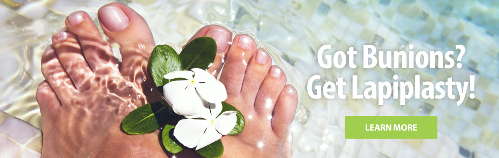 Got Bunions? Get Lapiplasty! Learn More